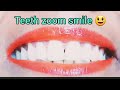 Teeth Zoom Smile Challenge Video Very Fanny Video Request Video