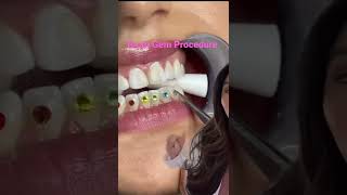 How to Put on Tooth Jewels  / Tooth Gems #shorts #braces #toothgems #cosmetics