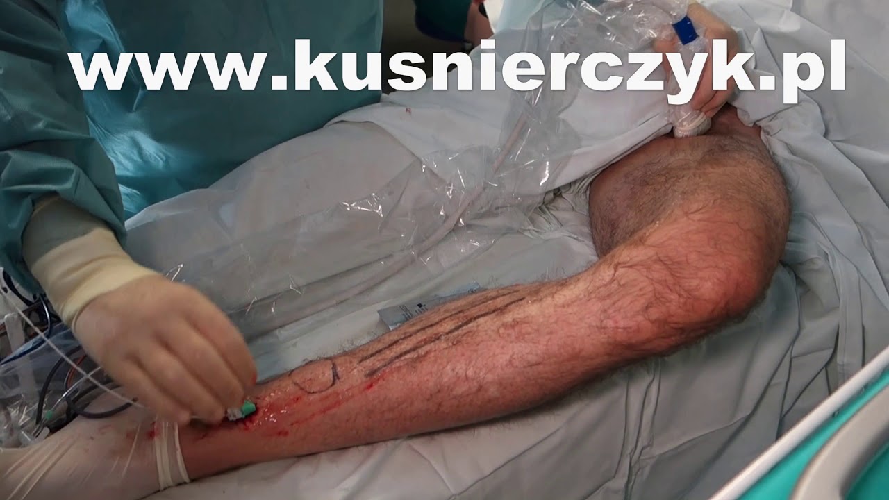 Roman Kuśnierczyk-18