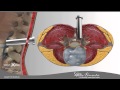 Lumbar Microdiscectomy Spine Center Northern Nevada Northern California Spine Surgery