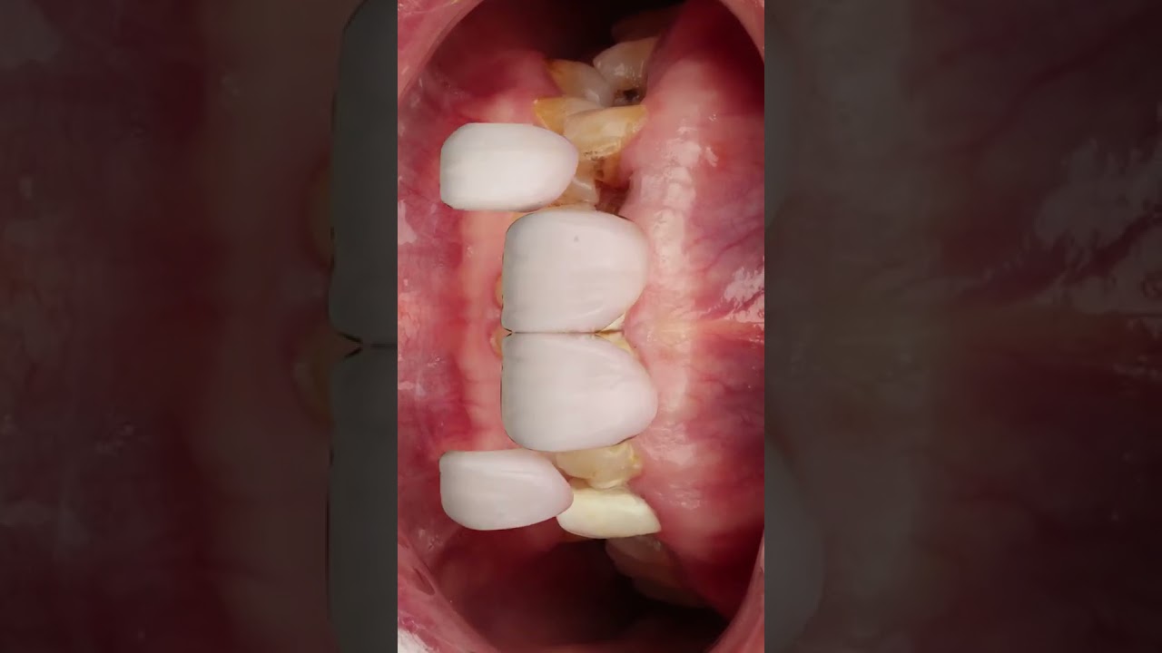 Full motion dental case video example one