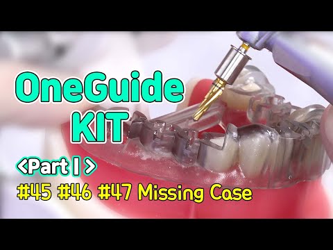 [EASY Hands-on] OneGuide KIT PartⅠ- #45, #46, #47 Missing Case