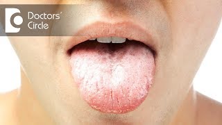 What does a white tongue in the morning mean? - Dr. Srivats Bharadwaj