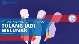 Osteomalasia, Kelainan pada Tulang yang Menyebabkan Tulang Menjadi Lunak dan Mudah Patah