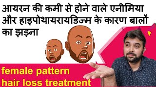 preview picture of video 'Hair loss due to iron deficiency anemia and hypothyroidism | female pattern baldness part - 2'