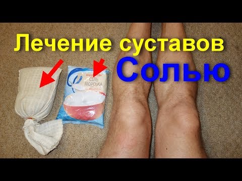 Кровоизлияние в голеностопном суставе Лечение позвоночника в новосибирске все клиники