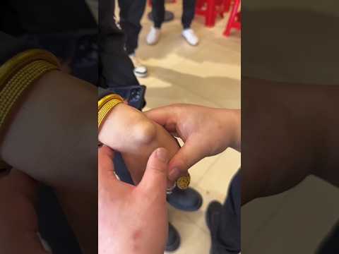 E1645 The lump on😲🥚😵the lady's hand🥳😝was as big as an egg,but now there's not a trace left.