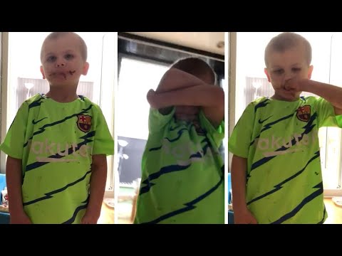 Mum Launches Card Appeal For Son Who 'Hates His Face'