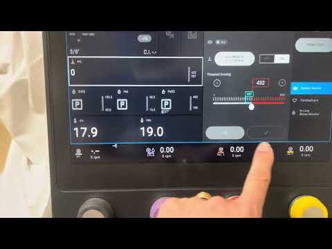 What the Thomas program looks like on the essenz heart lung machine