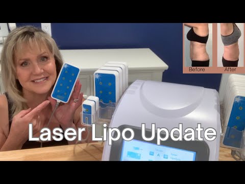 UPDATE!! Laser Lipo | SLIM DOWN and LOSE INCHES!! | Non-Surgical Laser Lipo Fat REMOVAL