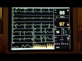 ECG KM 150 Minimo Baltas Portable electric kavamalė