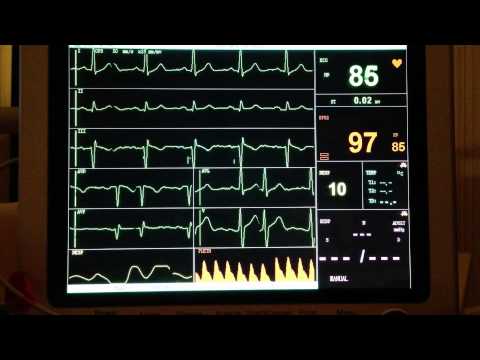 ECG KM 150 Minimo Baltas Portable electric kavamalė video