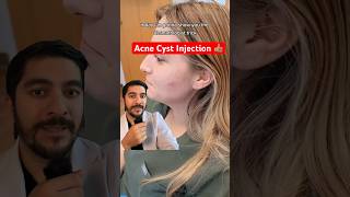 Download lagu Fastest Way To Treat Acne Cyst mp3