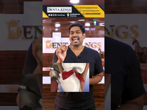 கேப் பொருத்திய பல்லில் வலி ஏன் வருகிறது? What is high points |Dental crowns| Denta Kings