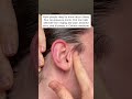 👂🏼 Blocked ears, buzzing or woozy head?