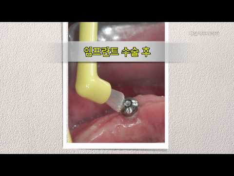 특수 목적 칫솔 사용법 영상 썸네일