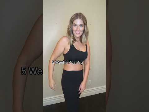 Skin Removal After 100+ Pound Weight Loss