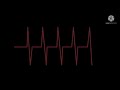 Heart  dying sound effects  in hospital.