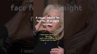 ￼A cougar mauled her face for 15 straight minutes ￼