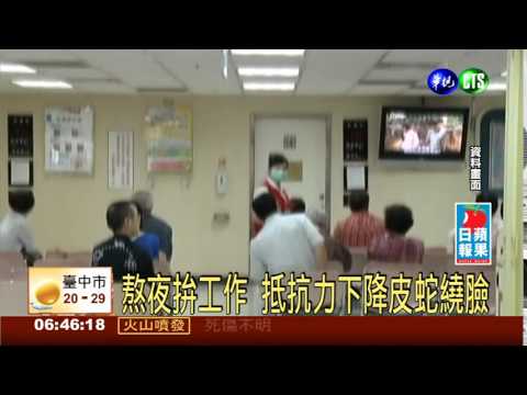 熬夜拚工作 抵抗力下降皮蛇繞臉