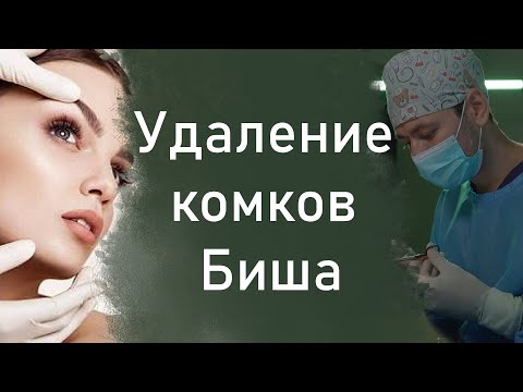 Yuz estetik operatsiyalari #1
