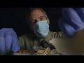 The Reconstruction Of Humpty Dumpty ASMR