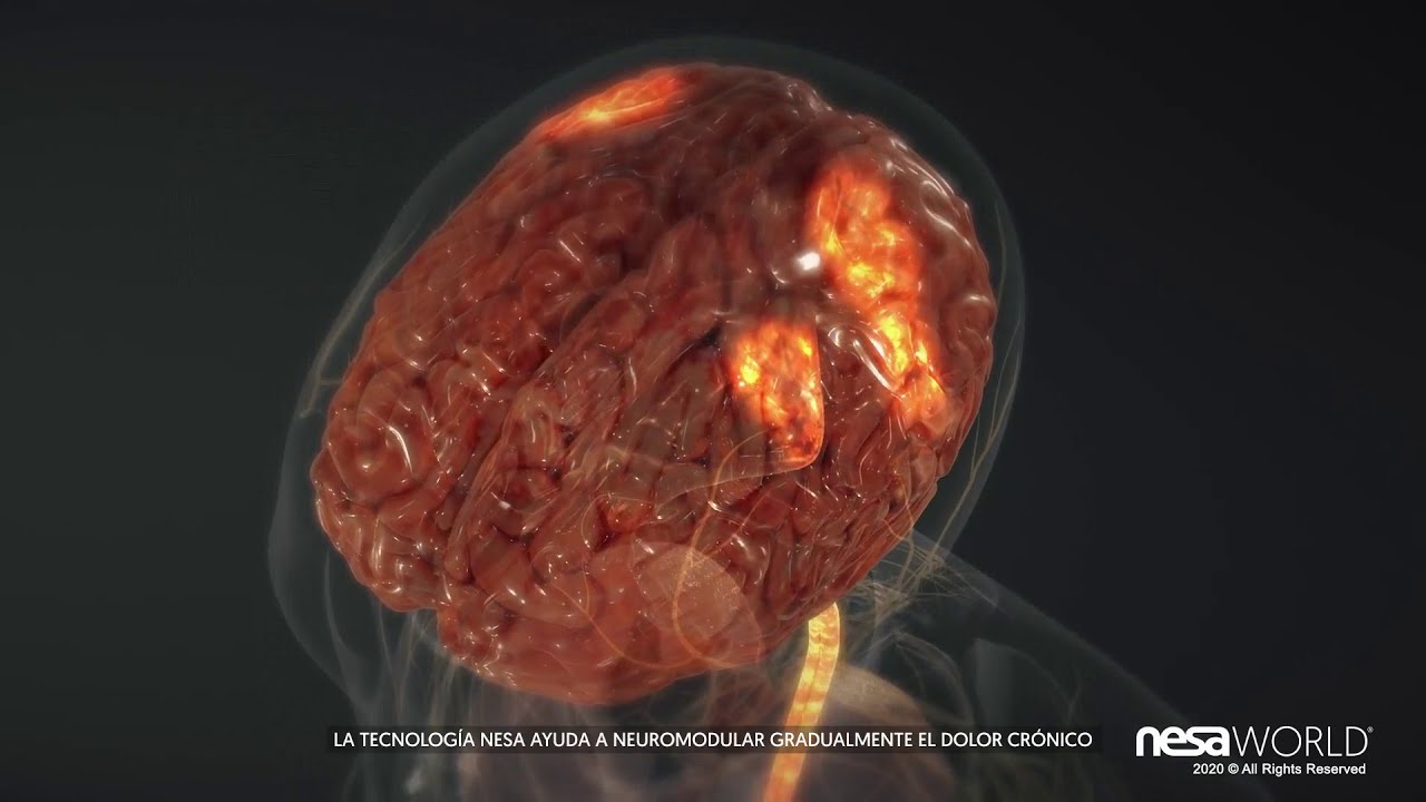 Tratamiento Neuromodulación no invasiva para dolor crónico, insomnio, estrés...