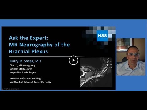 Image - Ask the Expert: Brachial Plexus MR Neurography
