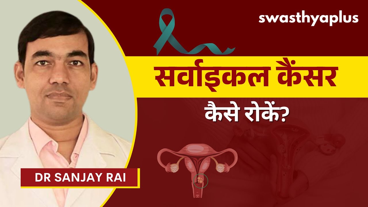 सर्वाइकल कैंसर को कैसे रोकें? | Cervical Cancer: Symptoms & Treatment, in Hindi | Dr Sanjay 
