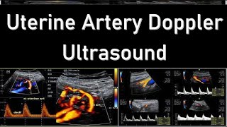 Uterine Artery Doppler Ultrasound Interpretation / Doppler Ultrasound in Fetal Growth Assessment