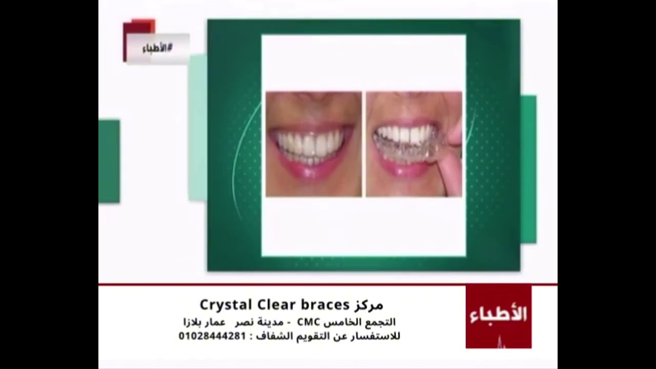 ايه شكل التقويم الشفاف