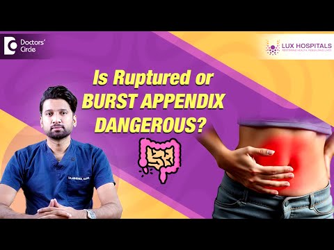 Appendix operation|Danger of Appendix rupture| Laparoscopic #appendicitis  removal-Dr.Abhishek Katha
