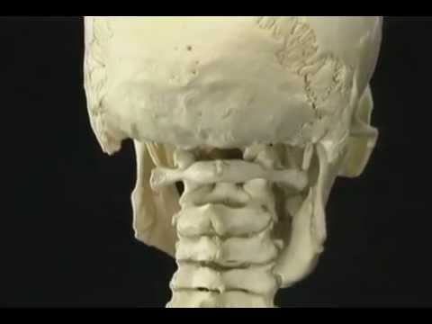Impianto organico nel giunto Che curare protrusione del rachide cervicale