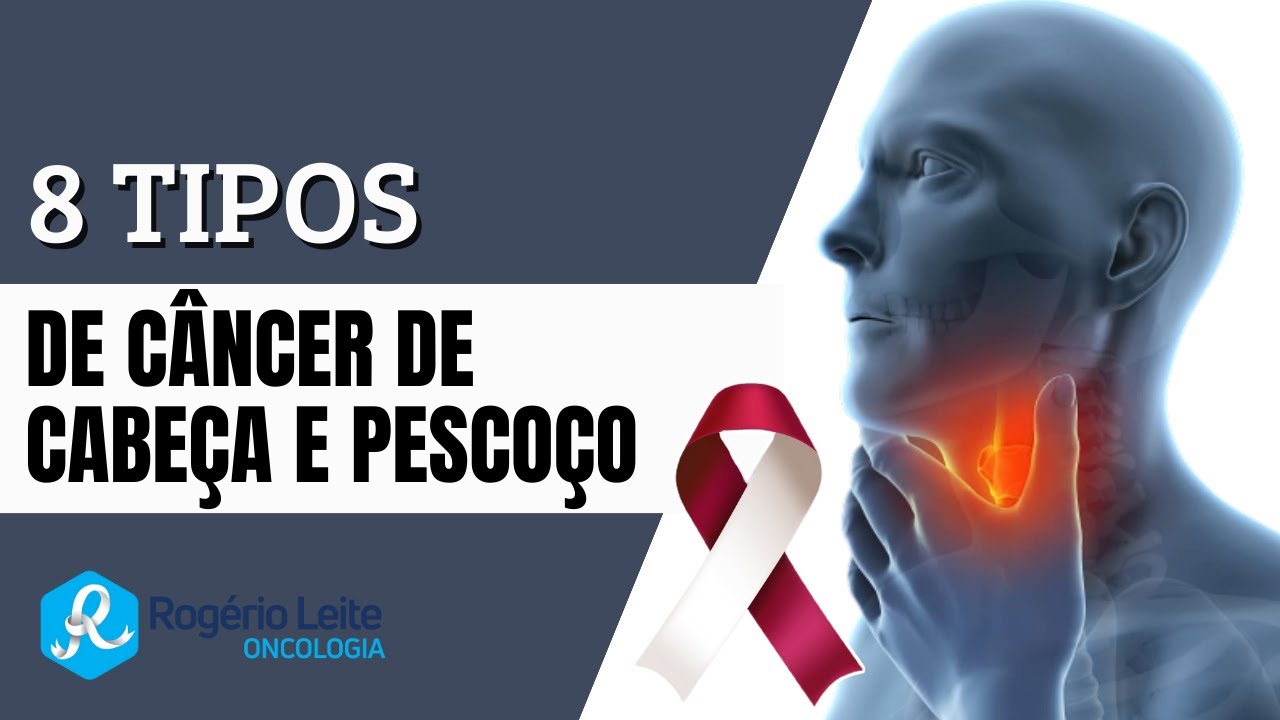 8 Tipos de câncer de cabeça e pescoço
