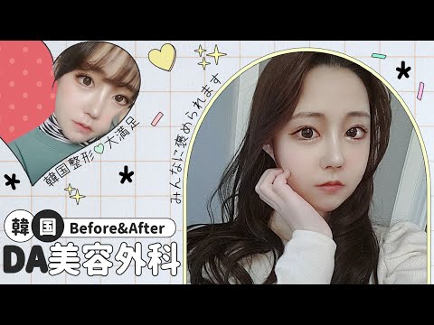 動画 韓国整形bijoo 可愛すぎる女の子の動画