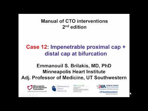 Case 12: Manual of CTO Interventions - Impenetrable proximal cap + distal cap at bifurcation