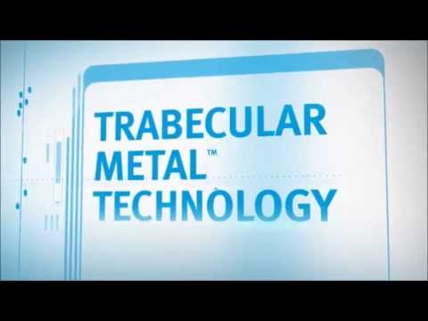 Zimmer Trabecular Metal Technology