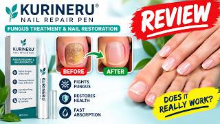 🔥 KURINERU NAIL REPAIR PEN REVIEW – BENEFITS, BEFORE & AFTER - RESULTS - CUSTOMER REVIEWS