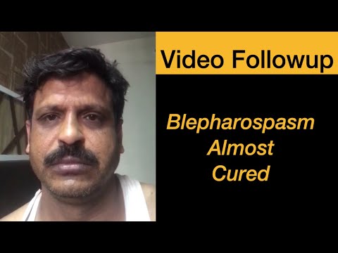 Blepharospasm cured in a patient from Madhya Pradesh