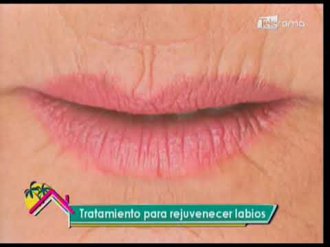 Tratamiento para rejuvenecer labios