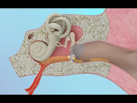 Vindecarea verucilor genitale după cauterizare