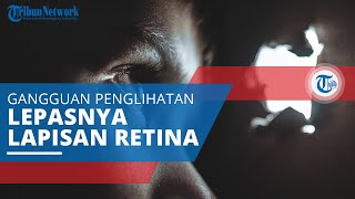 Ablasi Retina, Gangguan Mata yang Bisa Menimbulkan Kebutaan akibat Lepasnya Lapisan Tipis Retina