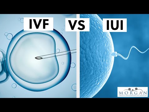 IUI vs IVF: What's the difference?
