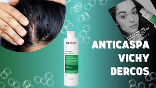 Vichy Dercos,(COMPROVADO),Caspa, Anticaspa,Tratamento da Caspa, Vichy Dercos Shampoo Anticaspa