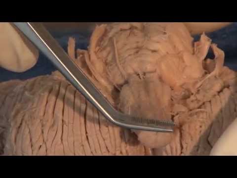 Cranial Nerves: Neuroanatomy Video Lab - Brain Dissections
