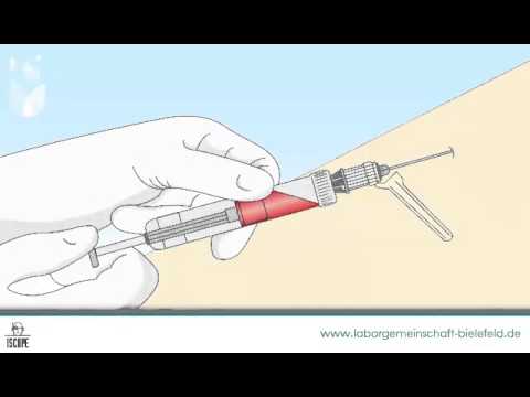 Laborgemeinschaft Bielefeld - Die Blutentnahme mit Hilfe des Aspirationssystems