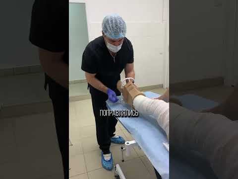 Как надевать компрессионные чулки легко ? #флеболог #доктор #чулки #флебологвмоскве