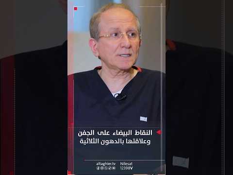 شاهد بالفيديو.. النقاط البيضاء على الجفن وعلاقتها بالدهون الثلاثية