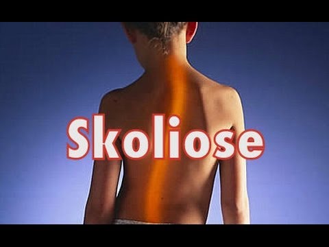 Wunder Hals auf der linken Seite der Schulter Schwangerschaft Schmerzen im Rücken und Beine