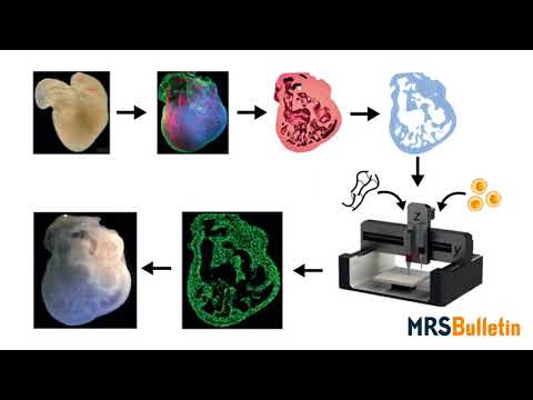 3D bioprinting of organs
